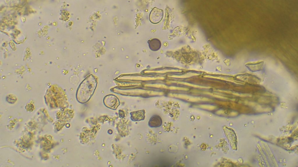 image au microscope de champignons et de bactéries